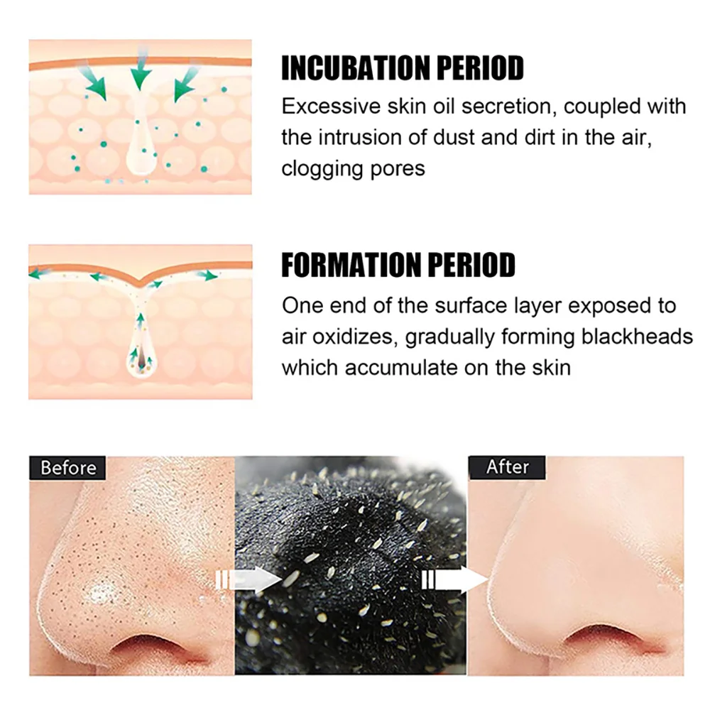 10/20/50/100PCS Tiras Nasais p - Charcoal Pore Strip avaliação e preço